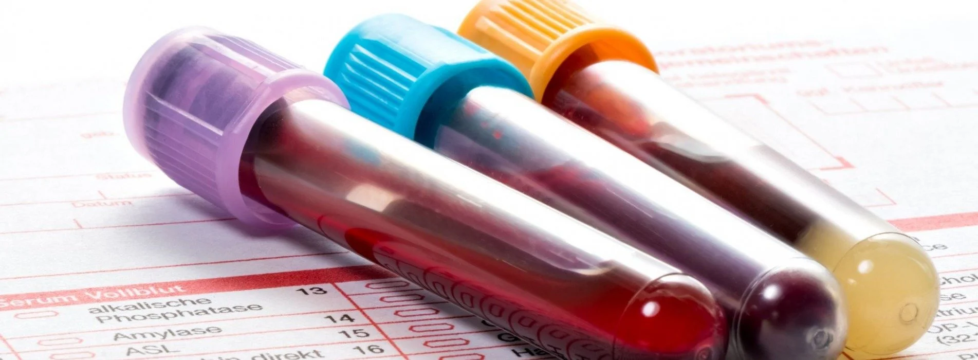 Phlebotomy Services (pricing varies)