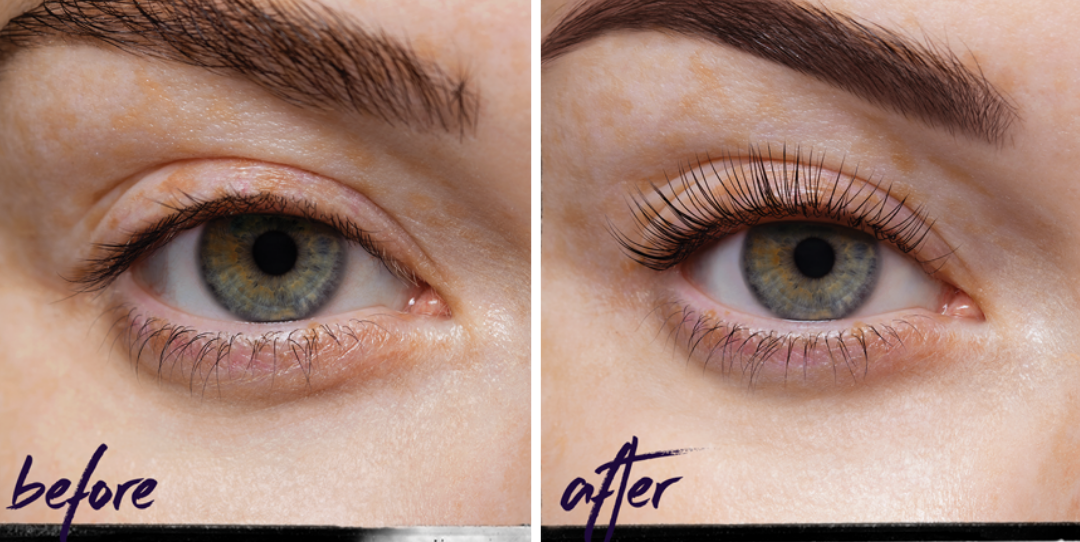comparison of eyelash enhancement