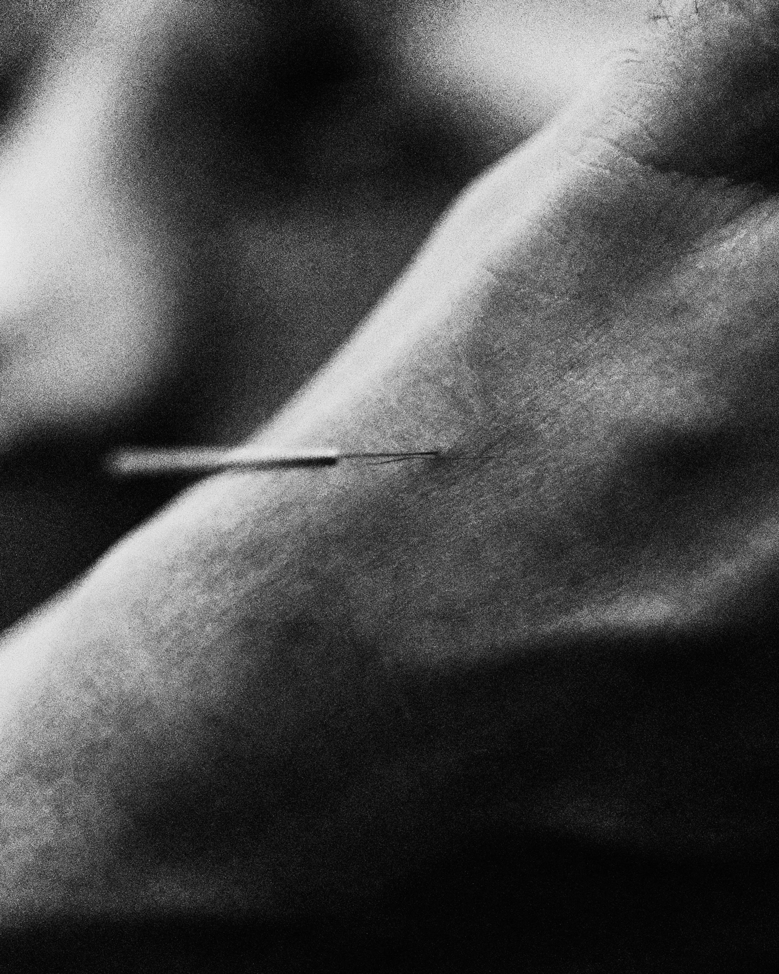 Black and white close-up photo of an acupuncture needle inserted into a foot