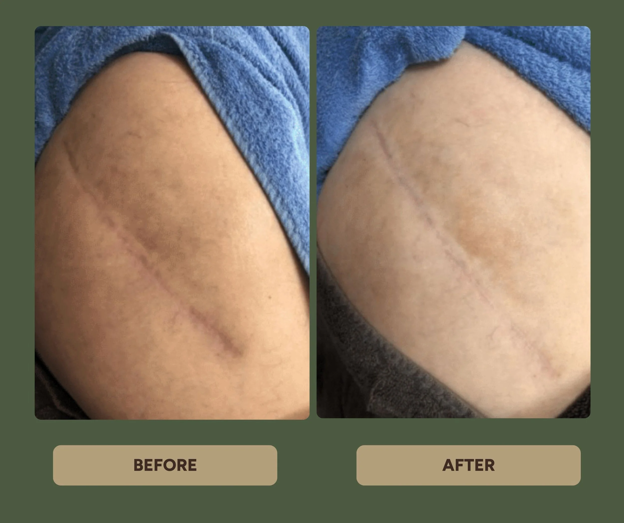 Training - Gentle Scar Therapy (2).jpg