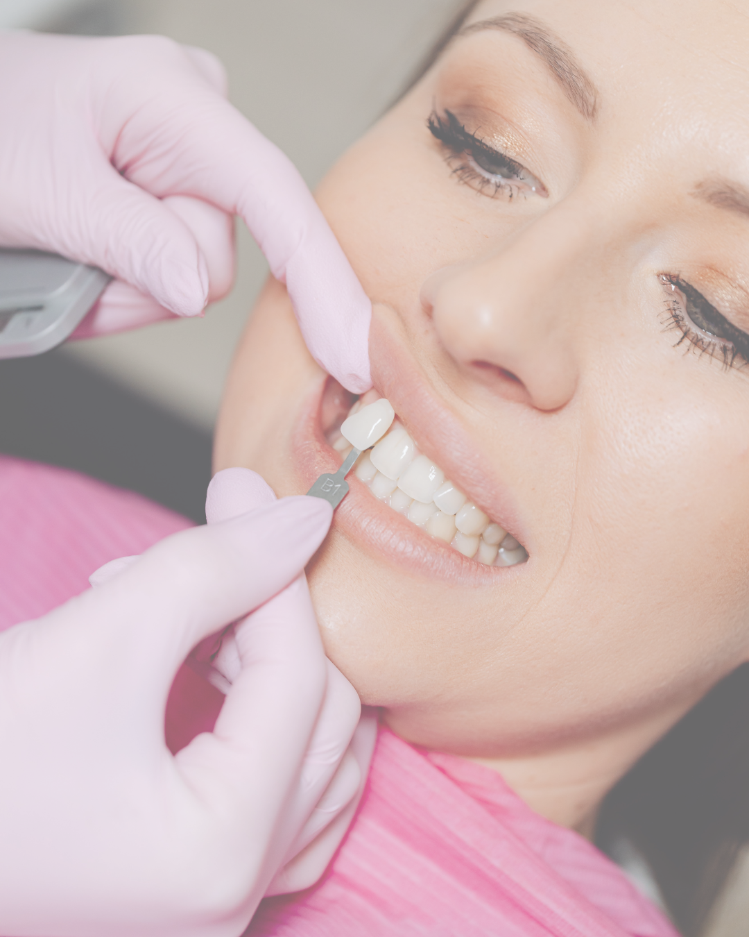 Dentist applying tooth whitening treatment to a patient using a shade guide during a dental procedure.