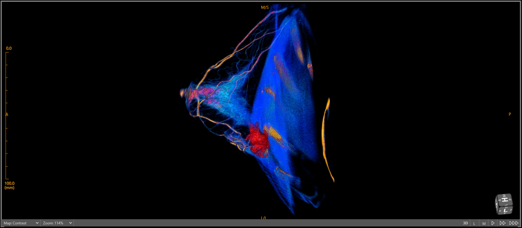 FAQs | Explore Breast CT Technology - Learn More — What to know about ...