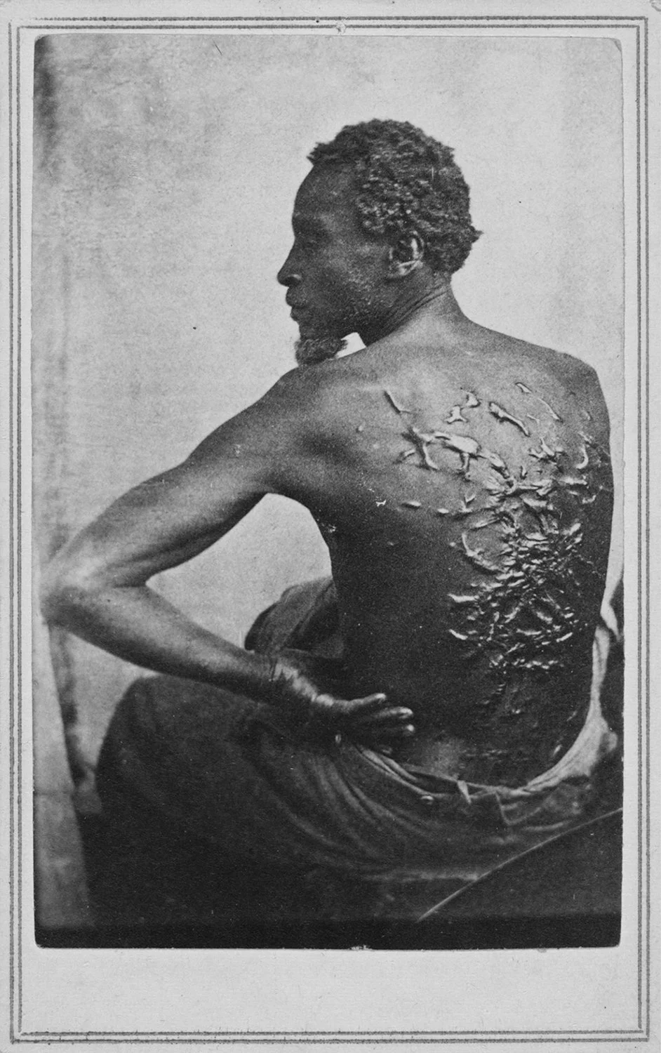 Source Image: "The Scourged Back" photograph by McPherson & Oliver, 1863
