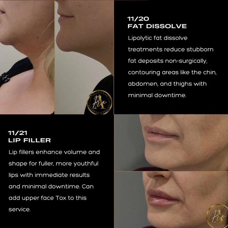 Join our Houston Model Call to receive discounted treatments including fat dissolve, lip fillers, biostimulators, and PDO threads. This is a great opportunity to enhance your natural features, improve skin contour, and achieve a more youthful, radian