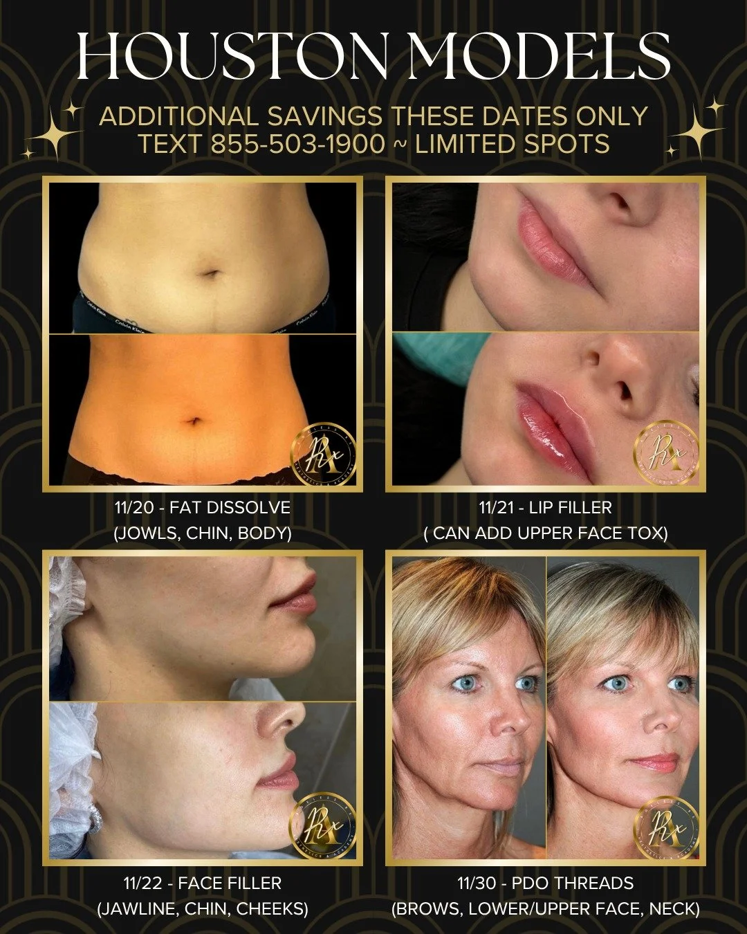 📣Houston Models ~ SAVE MORE THIS MONTH ONLY on these services:

✨11/20 ~ Fat Dissolve (reduce stubborn fat in chin, jowls and body)
✨11/21 ~ Lip Filler (classic &amp; Russian, add volume, contour and plump lips)
✨11/22 ~ Face Filler (replenish lot v