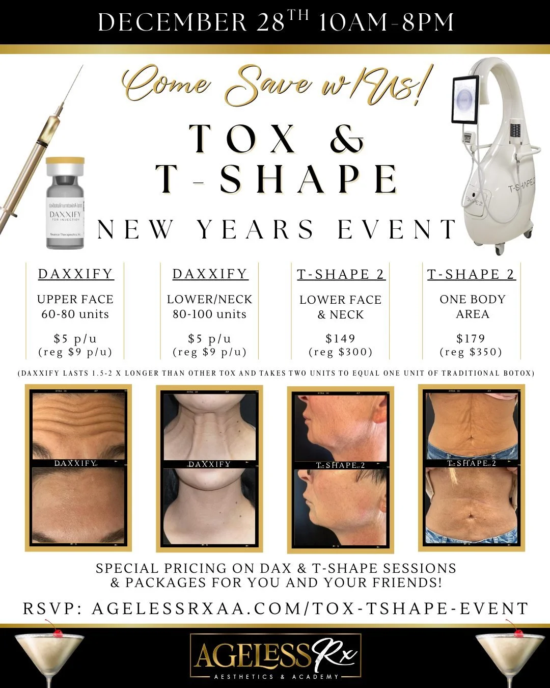 🎉Our 2nd Tox &amp; T-Shape Event appointments are almost completely book! Come celebrate the new year with our biggest discounts of the year on our Tox (Daxxify) &amp; T-Shape treatments. Our last event sold out! Enjoy exclusive offers on our signat