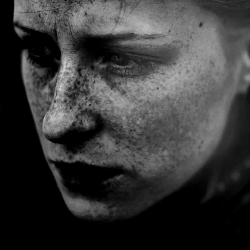Close-up black and white photo of a person's face with freckles, showing a serious expression.