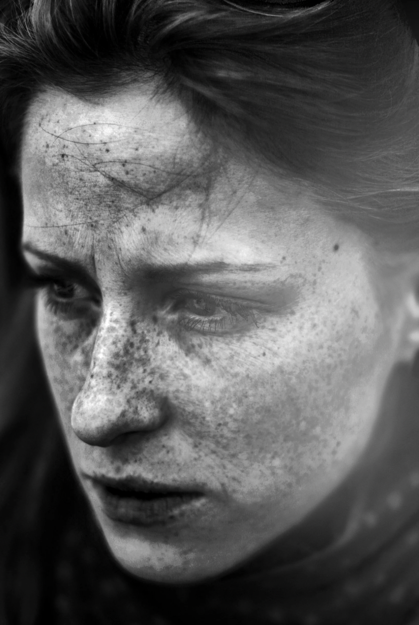 Black and white close-up of a person's face, showing freckles, with a contemplative or serious expression, partially obscured by shadows.