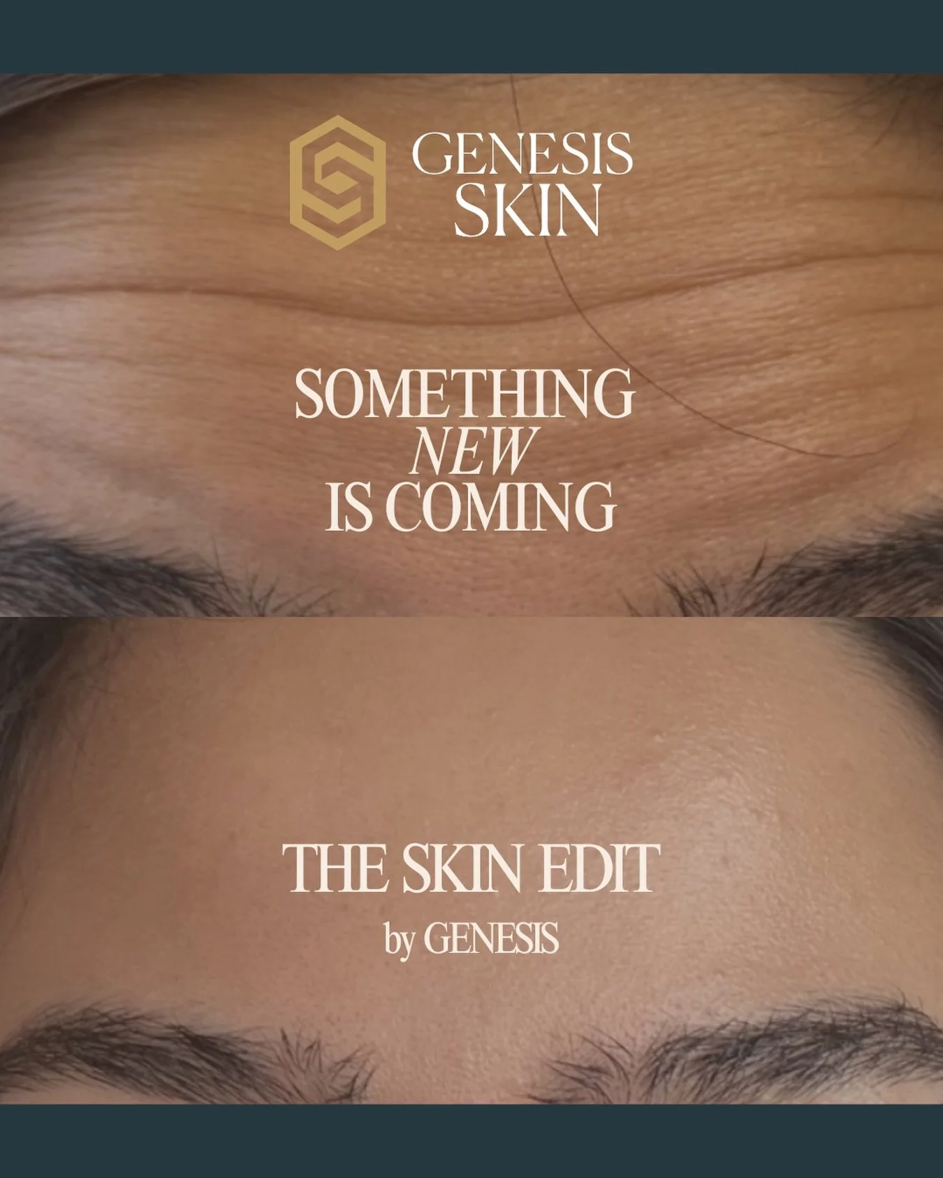 Take a sneak peek at The Skin Edit by Genesis Skin! 

Maintain + Protect
Correct + Refine
Transform + Preserve
✨
Discover the Genesis Skin Membership best fit for you in 2026! More details coming soon..
✨
Limited availability remaining this week for 