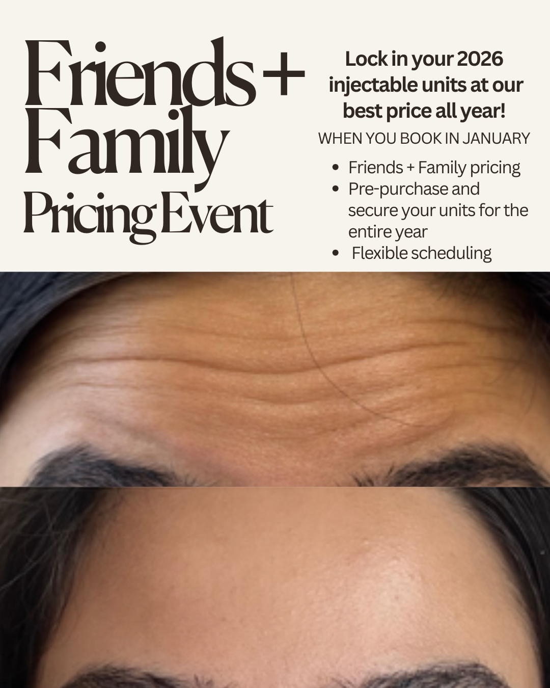Advertisement for a Friends and Family Pricing Event for injectable units in January, showing a before and after image of a person's forehead with reduced wrinkles.
