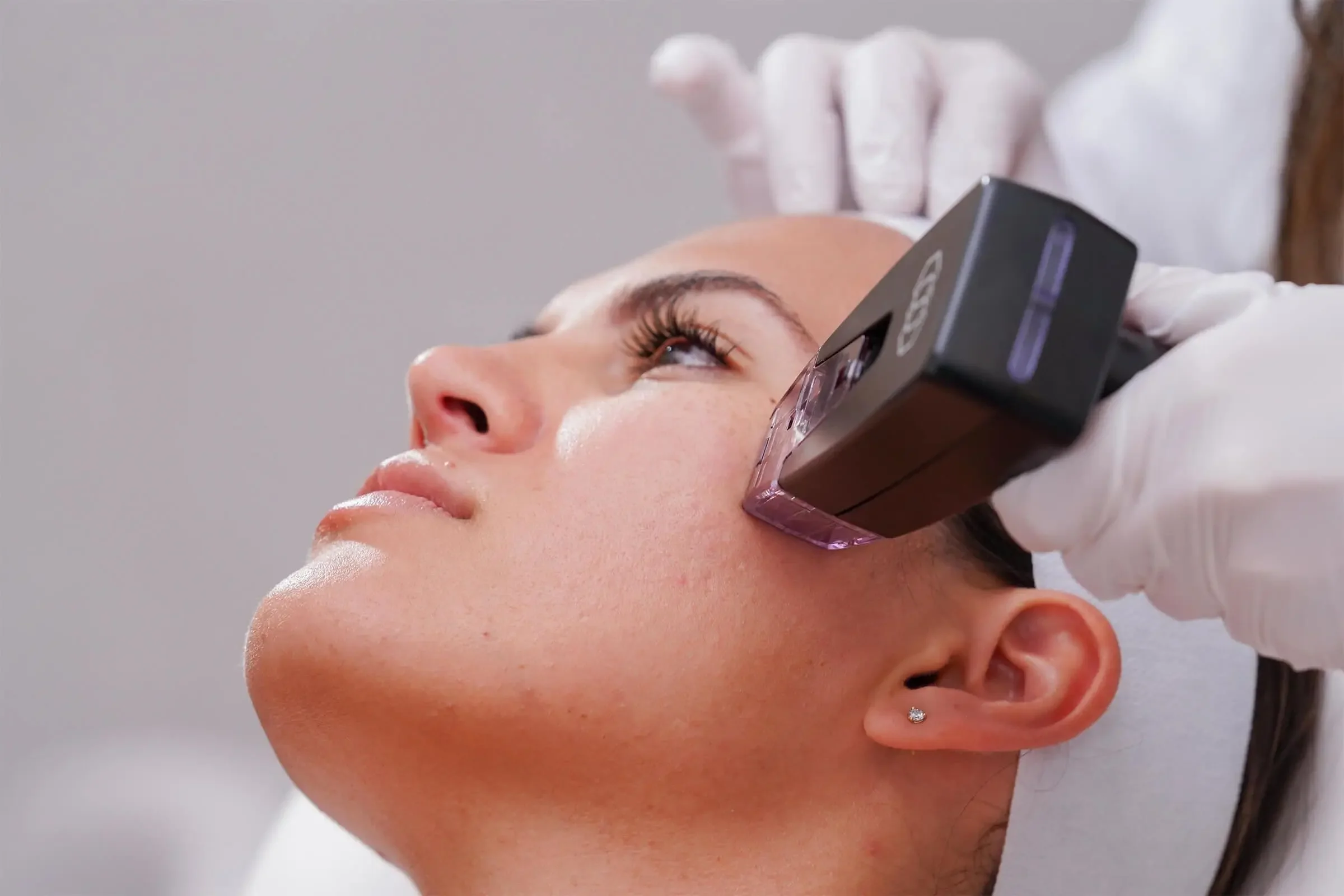 A woman receiving a facial treatment with a handheld laser device by a professional wearing gloves.
