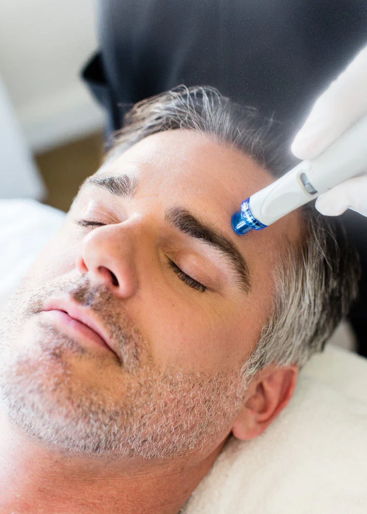 A man with gray hair and a beard is lying down with his eyes closed while a person wearing gloves uses a blue-tipped pen-like device on his forehead, likely during a cosmetic or dermatological procedure.