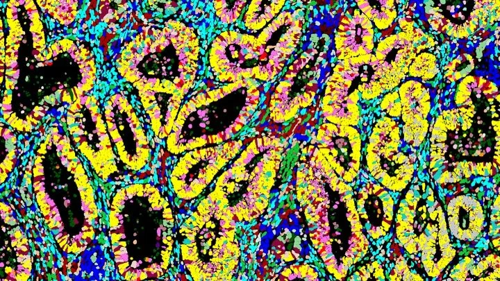 A colorful abstract mosaic pattern with swirling shapes and vibrant colors, including yellow, pink, blue, green, and black.