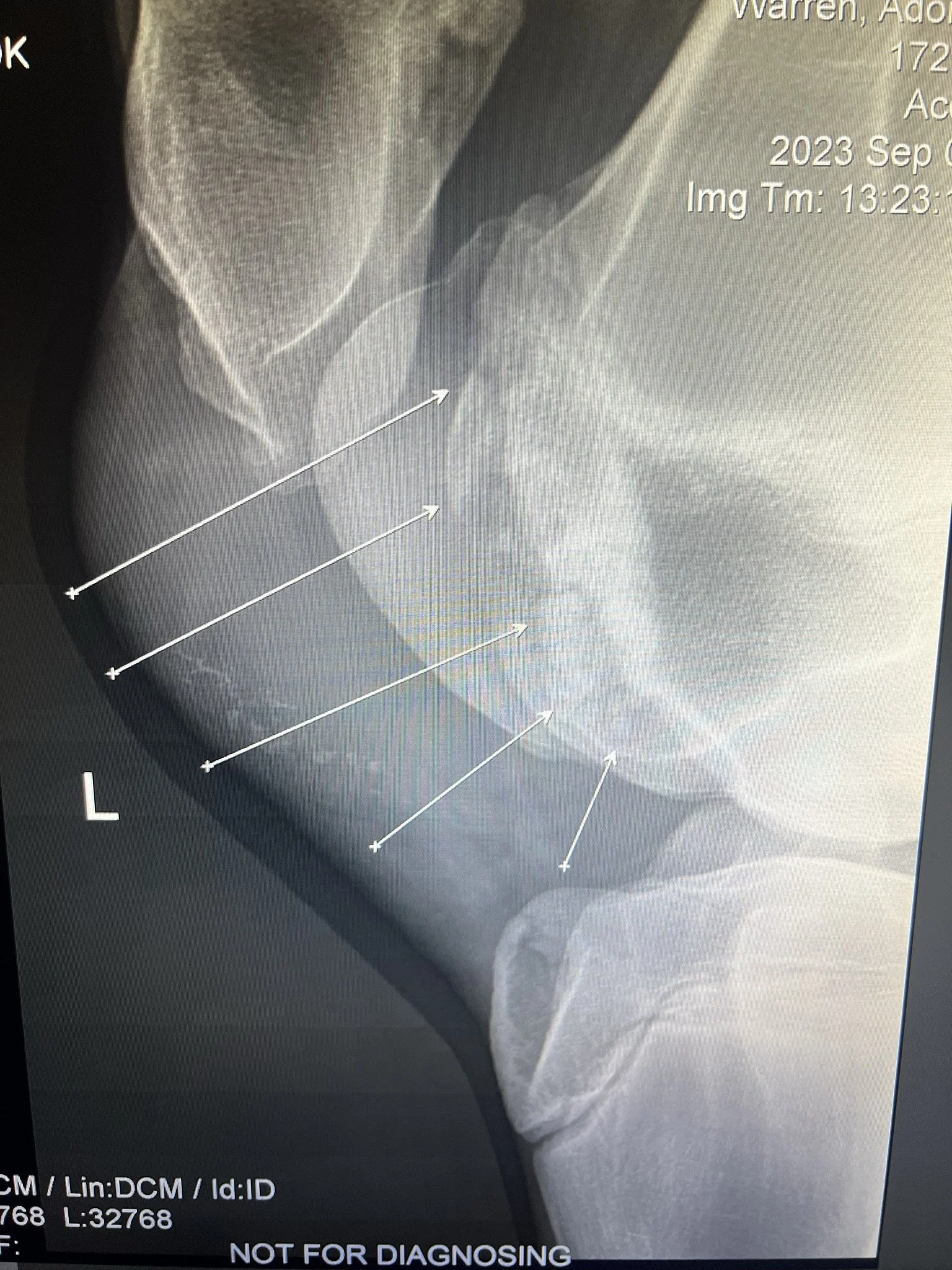 X-ray image of a left stifle showing multiple arrows pointing to areas of interest, with a label indicating it is not for diagnosing. The image includes medical details and date information.