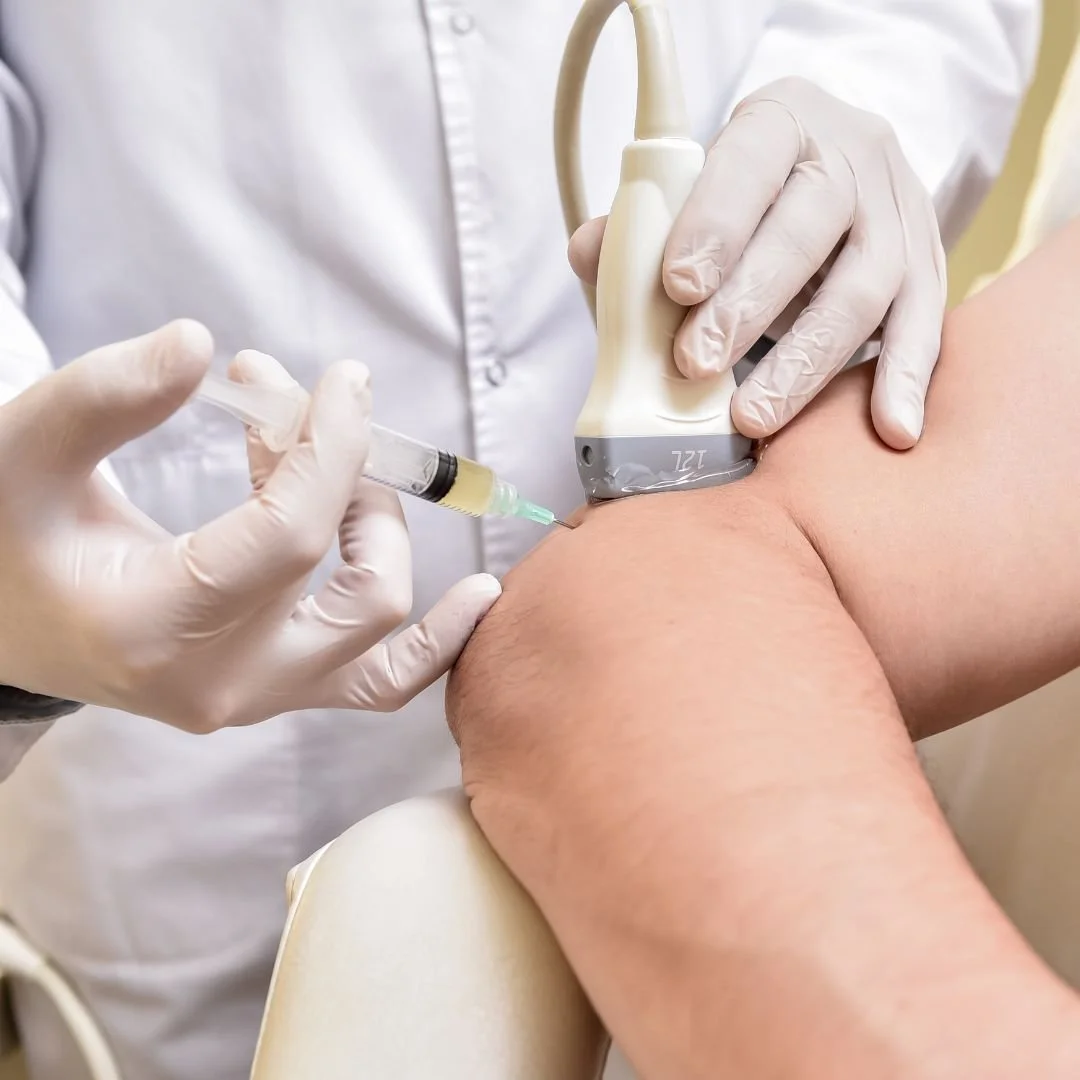 PRP pain injections in Windsor ontario