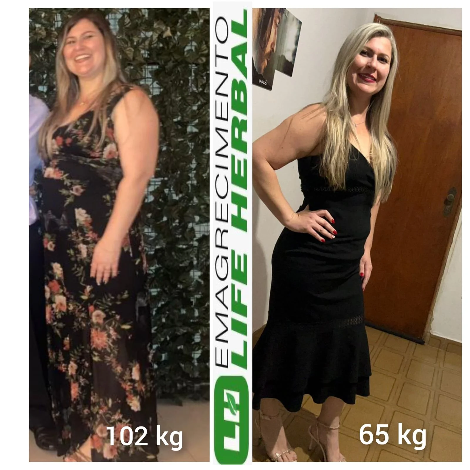 Imagem mostrando a transformação de uma mulher após emagrecimento, na esquerda ela está ganhando 102 kg usando vestido floral, e na direita ela está com 65 kg usando vestido preto, sorrindo e com cabelo loiro longo.