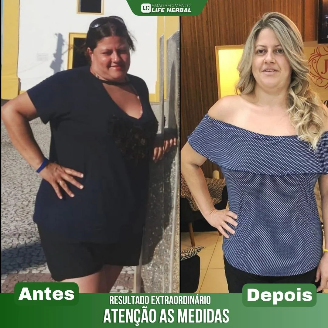 Mulher em duas fotos lado a lado, na primeira com aparência mais cheia, usando uma roupa preta, na segunda com aparência mais magra, usando uma blusa azul de ombro a ombro, em ambiente interno com iluminação quente.