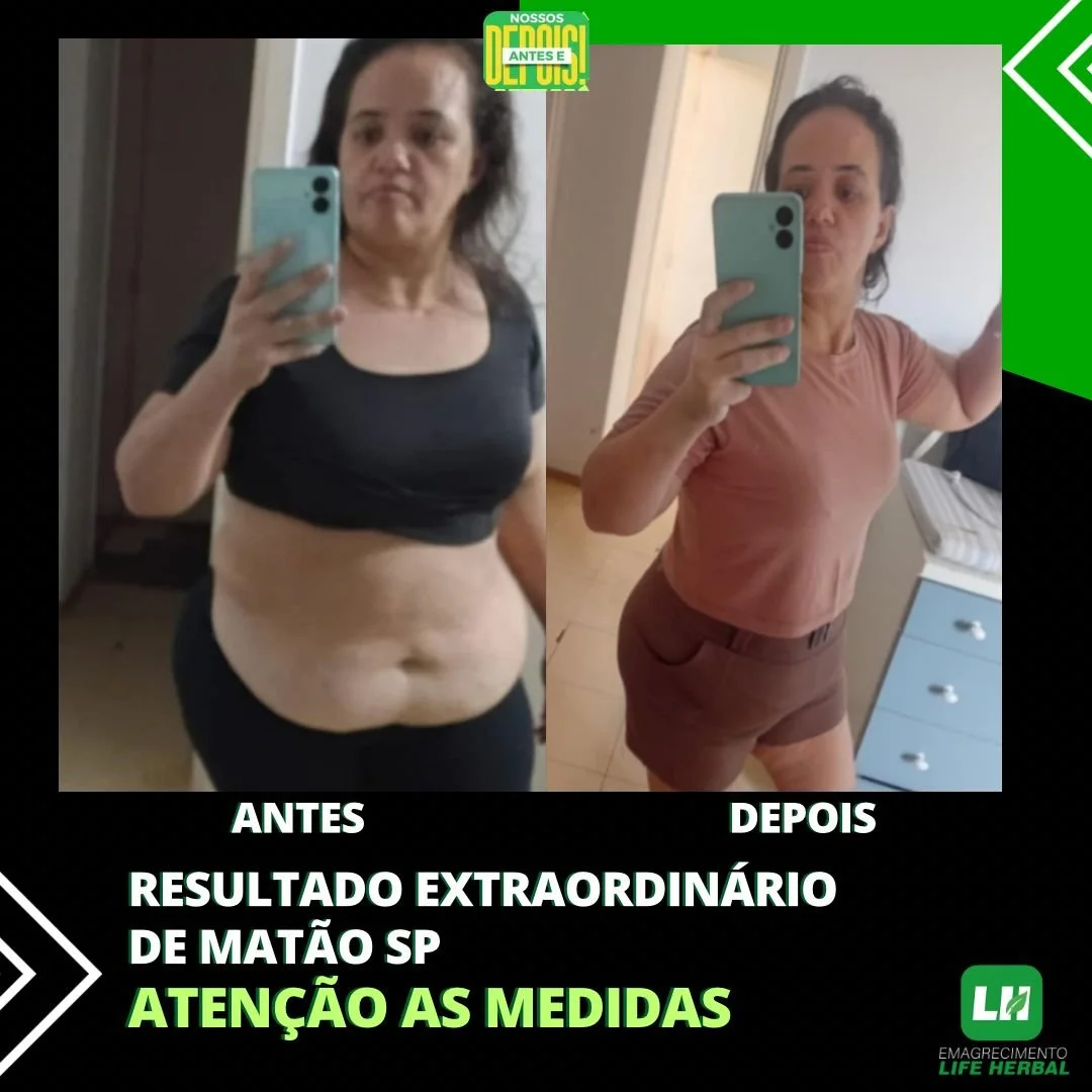 Imagem comparativa mostrando uma mulher antes e depois de um processo de emagrecimento, o lado esquerdo com ela mais gordinha usando blusa preta, e o lado direito magra usando blusa rosa. Texto enfatiza o resultado extraordinário de Matão SP e alerta para as medidas.