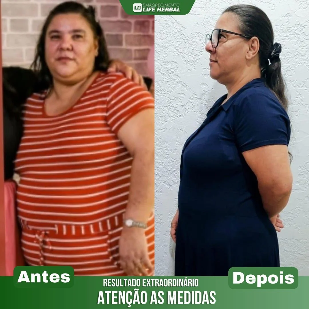 Antes e depois de uma transformação, mostrando uma mulher gorda na esquerda com uma camiseta laranja de listras brancas, e na direita uma mulher magra e de cabelo preso, vestindo uma blusa azul escura, ambas em fundos diferentes.
