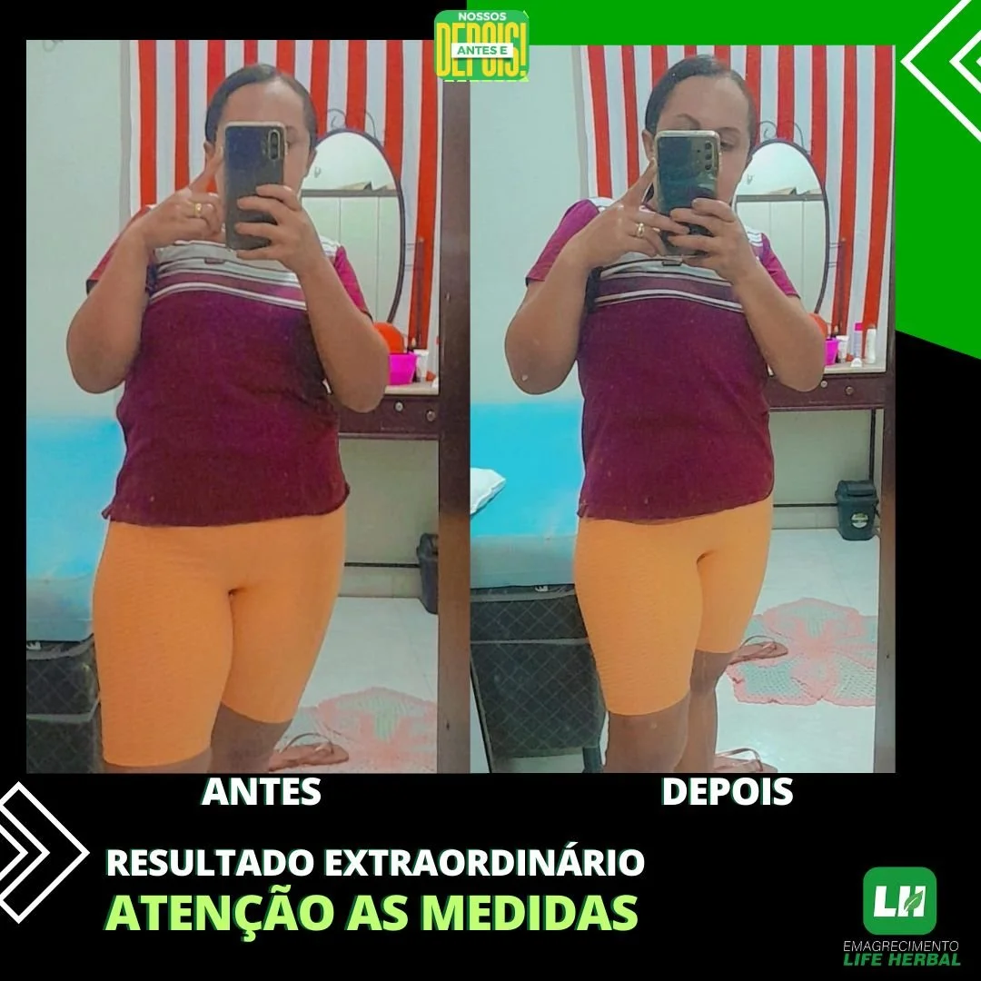 Antes e depois de uma transformação corporal, mostrando a pessoa de frente usando uma camiseta roxa e calças laranja, tirando fotos em espelho. O fundo tem cortinas listradas vermelhas e brancas e uma penteadeira com objetos. A imagem destaca o resultado de emagrecimento com legenda "Resultado extraordinário" e chamado para atenção às medidas.