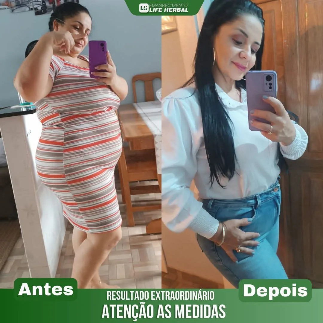 Imagem dividida em dois retratos de uma mulher. No lado esquerdo, ela antes de perder peso, vestindo um vestido listrado em tons de vermelho, cinza, branco e bege, e no lado direito, ela depois de emagrecer, usando uma blusa branca e jeans, sorrindo e tirando uma selfie.