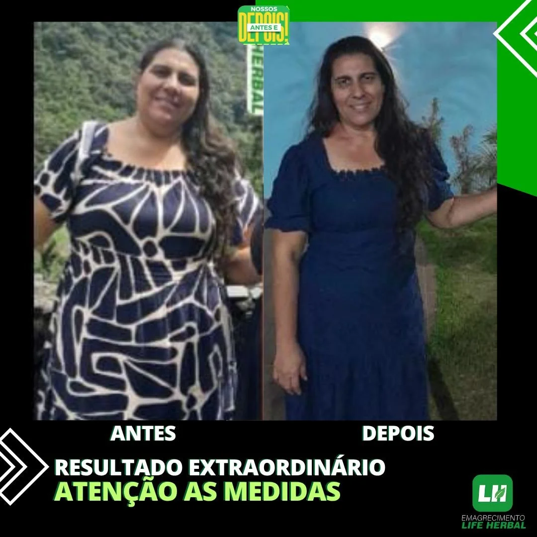 Imagem comparando uma mulher antes e depois de um tratamento de emagrecimento, com texto em português destacando resultados extraordinários e medidas corporais.