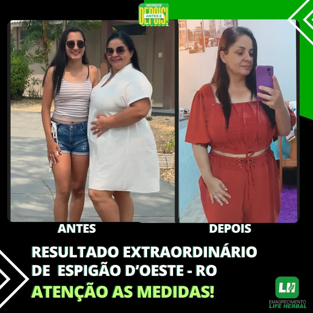Foto lado a lado de duas mulheres, uma mais jovem usando óculos escuros, camiseta listrada e shorts jeans, e uma mais velha vestindo um vestido branco. Do lado direito, a mesma mulher mais velha com cabelo liso preso, usando roupa vermelha, em frente ao espelho, fazendo selfie com celular roxo. Texto em destaque: "Antes" e "Depois" com legenda "Resultado extraordinário de ESPIGÃO D'OESTE - RO. Atenção as medidas!"