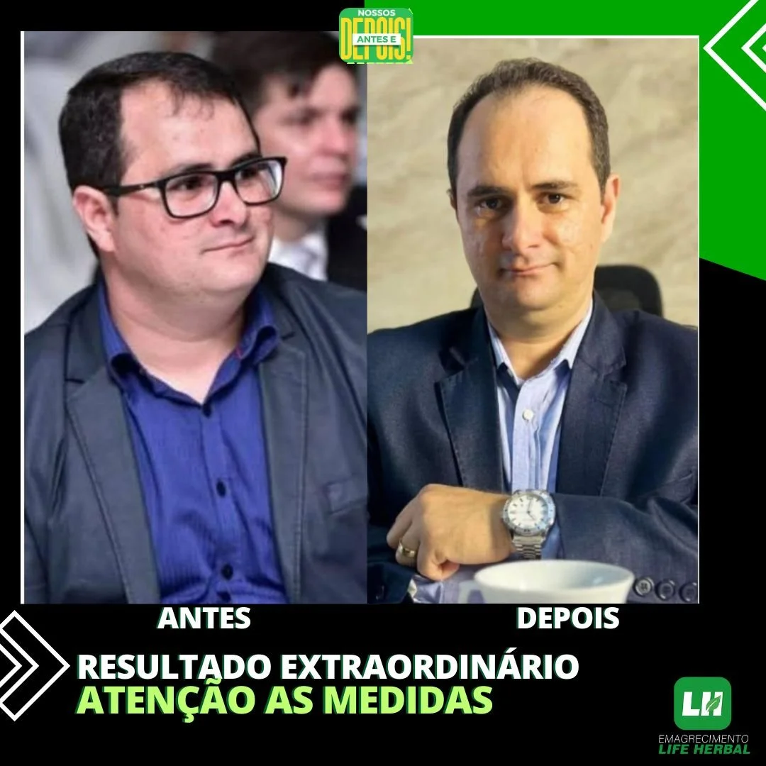 Imagem dividida ao meio, mostrando antes e depois de uma transformação de uma pessoa. No lado esquerdo, um homem com cabelo escuro, usando óculos, camisa azul e blazer escuro, com expressão séria. No lado direito, a mesma pessoa com cabelo mais ralo, aparentando estar mais saudável, usando camisa azul clara, blazer escuro, com postura mais confiante, com um fundo neutro e uma xícara na frente. Texto na imagem em português: "ANTES, DEPOIS, RESULTADO EXTRAORDINÁRIO, ATENÇÃO AS MEDIDAS".