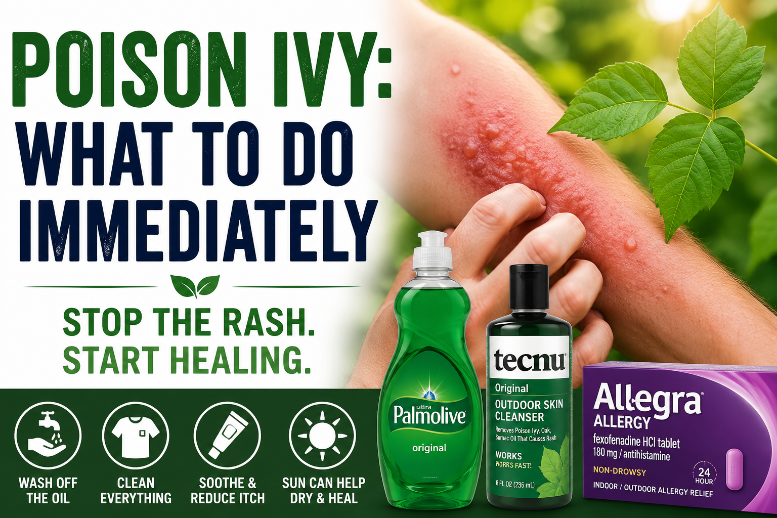 Stop Poison Ivy In Just a Few Days With This Protocol
