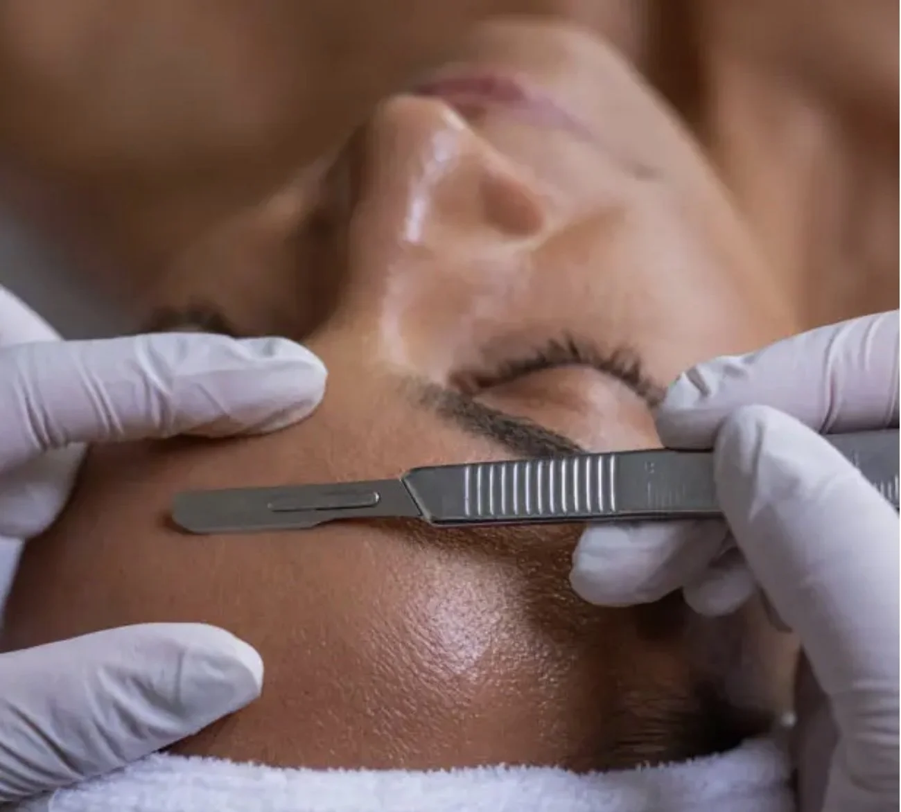 THE NIGHT WE MET (Dermaplaning)