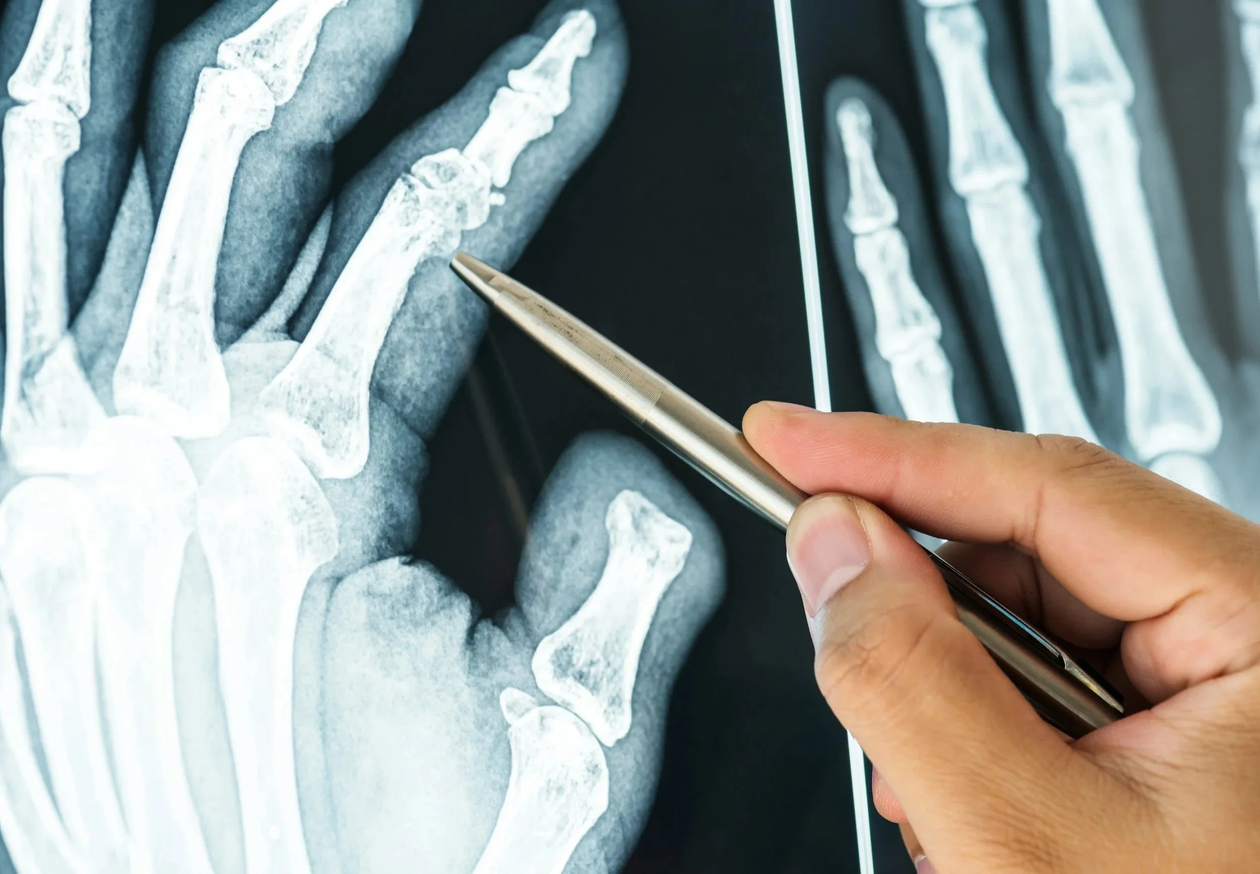 xray icon