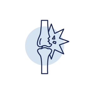Illustration of a knee joint with pain or injury indicator