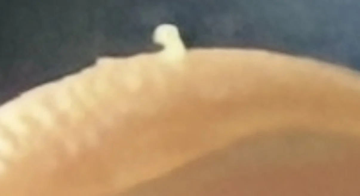 It fell from the ceiling apparently I think I got it on my thumb from my face beside my right side of my nose