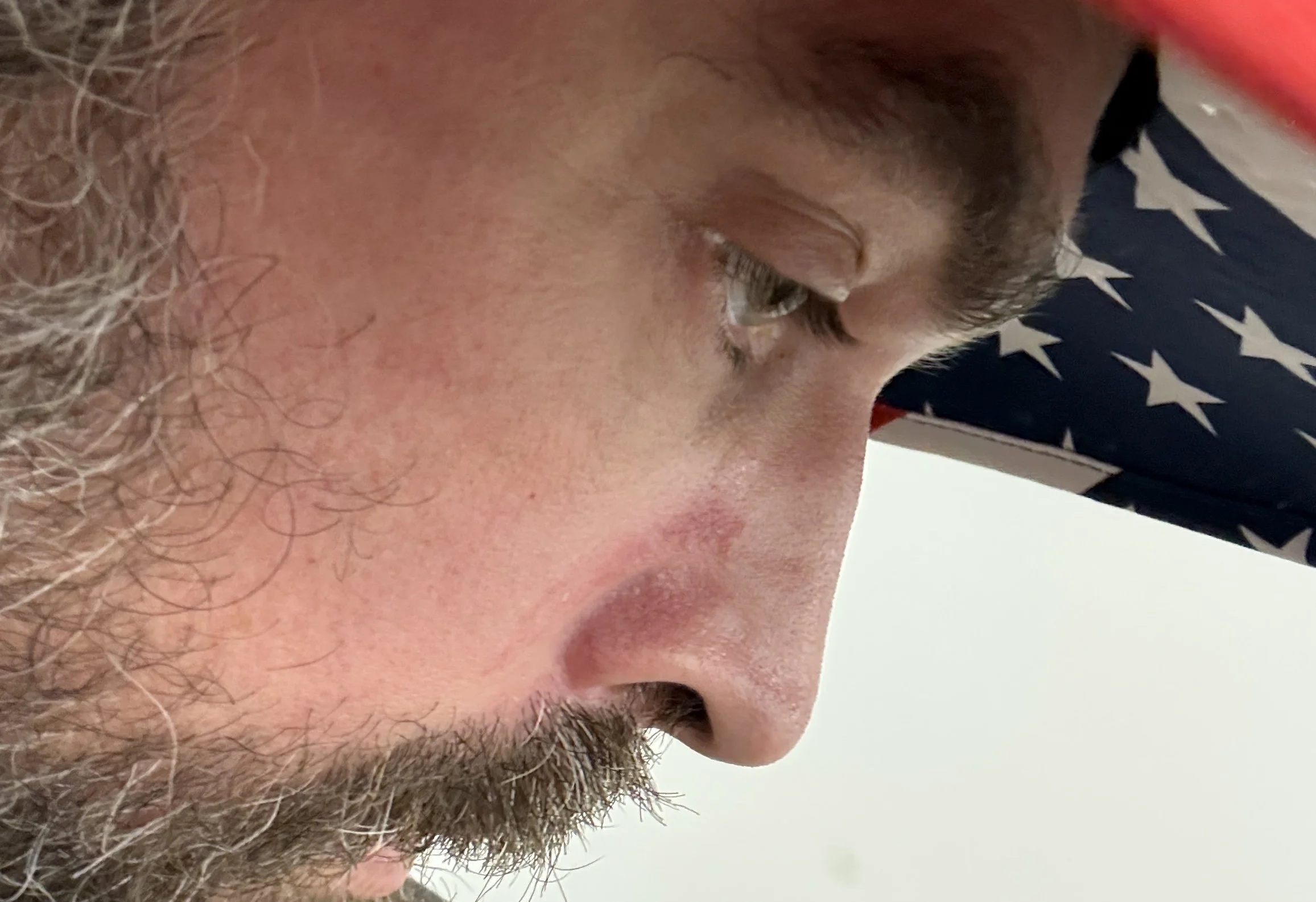 Yup and I said yes NG thanks for that