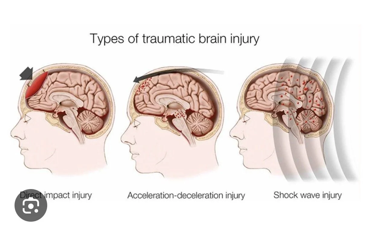 Um, I am slow sometimes to find my train of thought and even a helmet would not have lessened that blow 🧏🏻