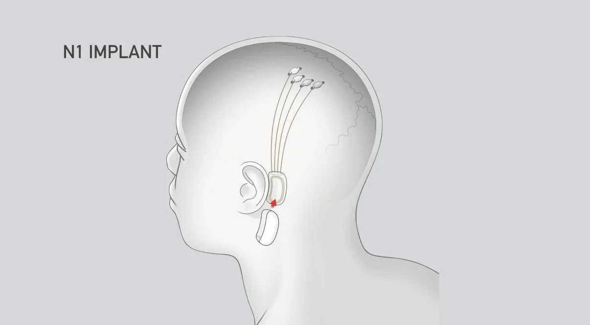 Neuralink 🧠
