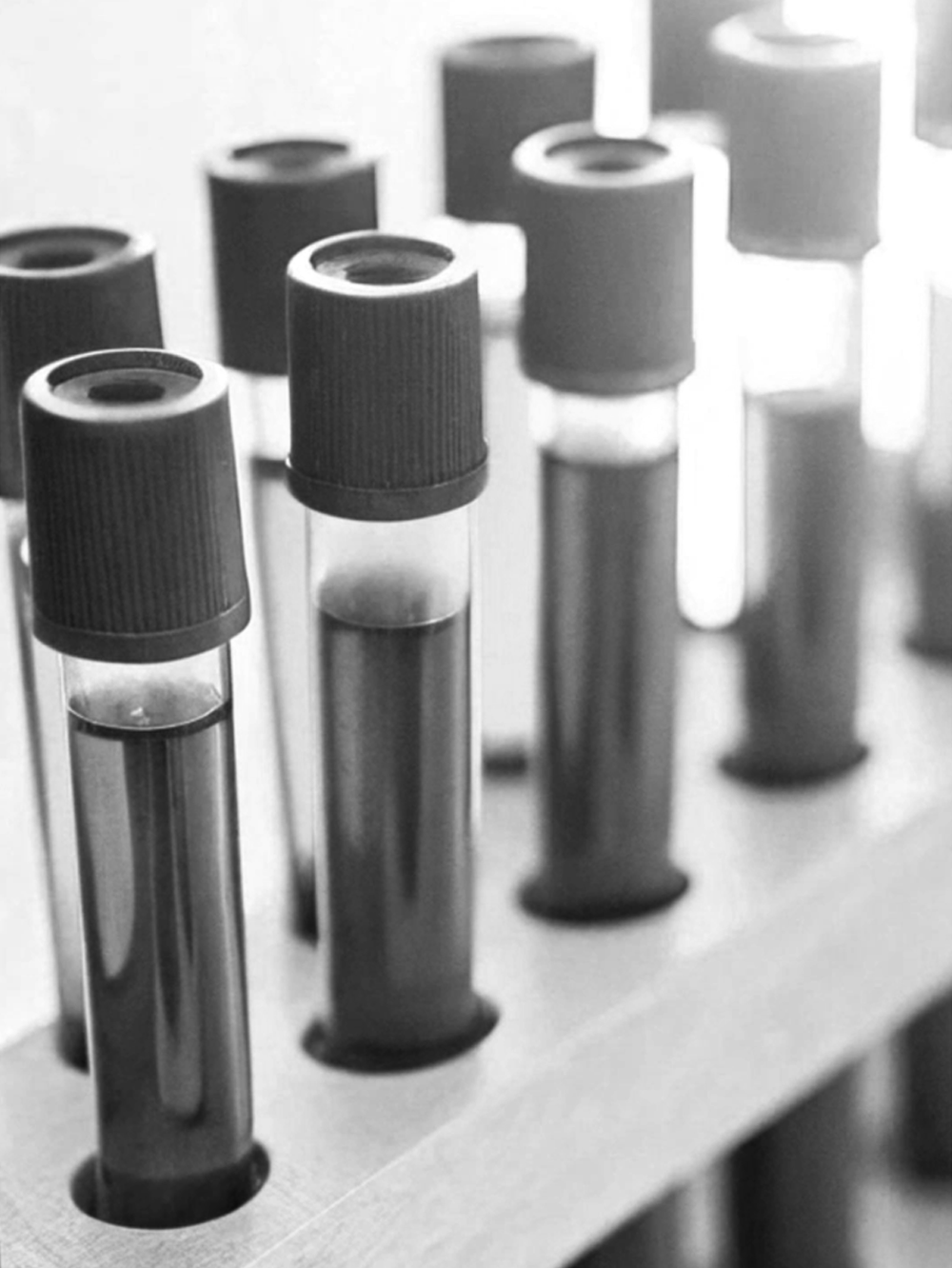 Close-up of test tubes with black caps in a clinical or laboratory setting.