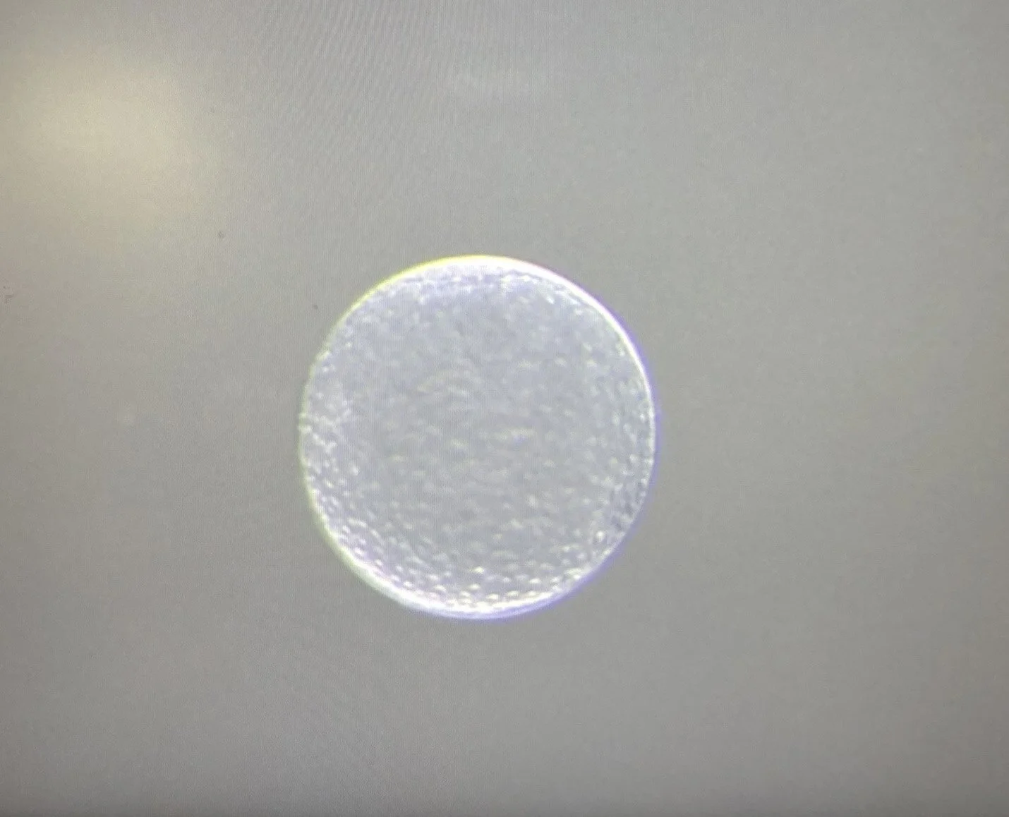 Equine embryo transfer.