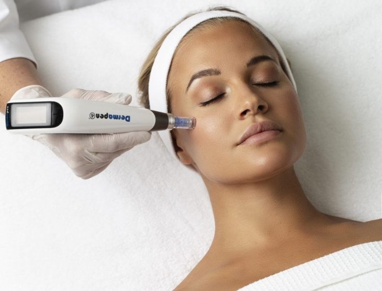 Microneedling