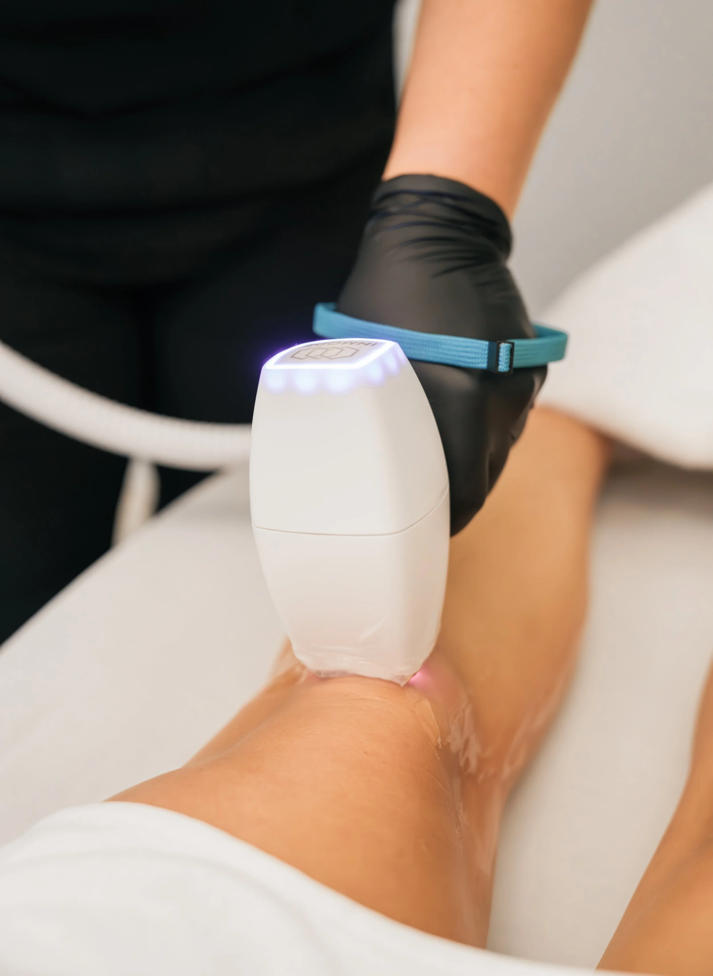 A medical professional using a laser device on a patient's lower leg during a treatment session.