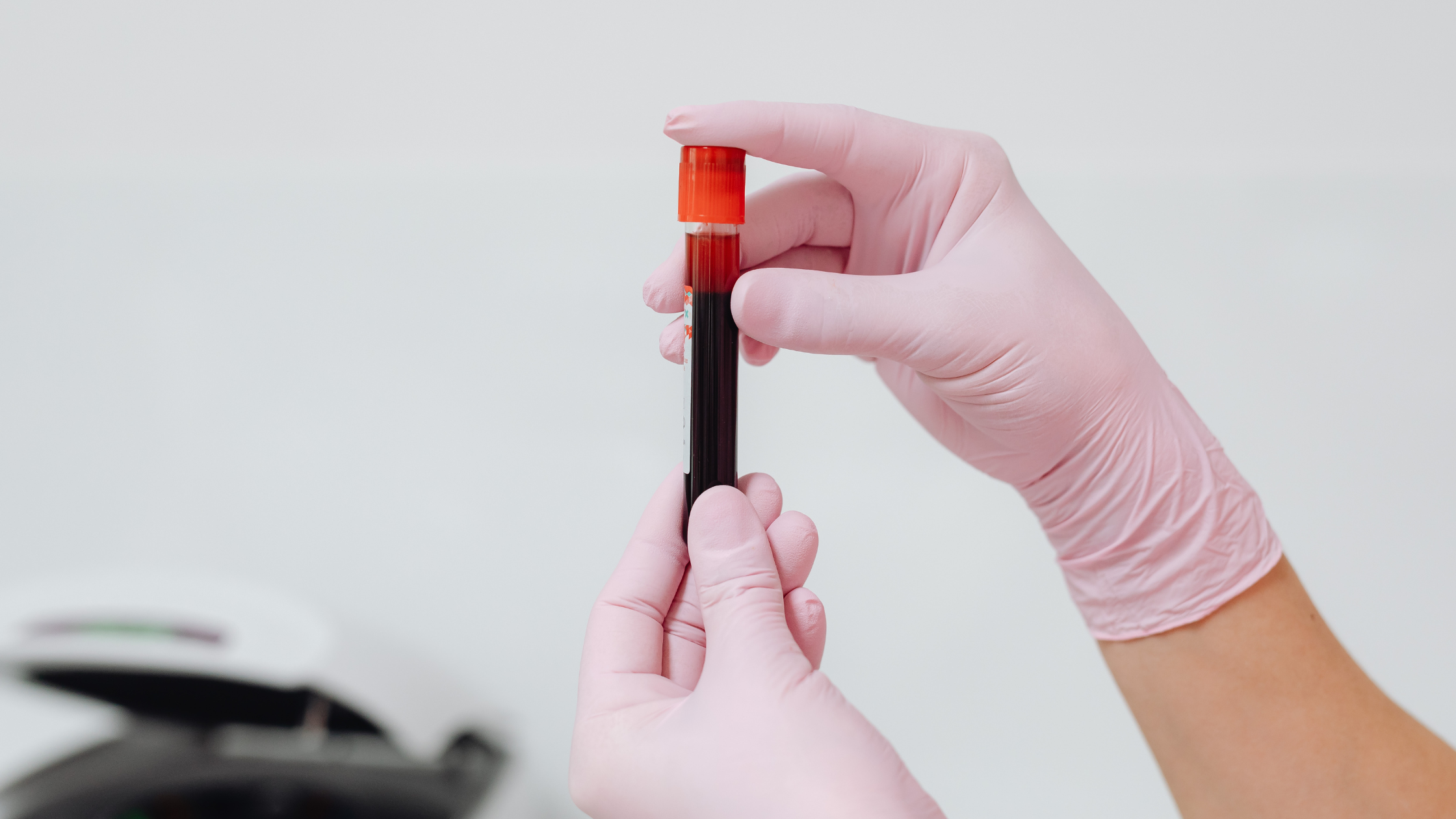 Ferritin Levels and Iron Deficiency: What the New 2026 ASH Guidelines Mean