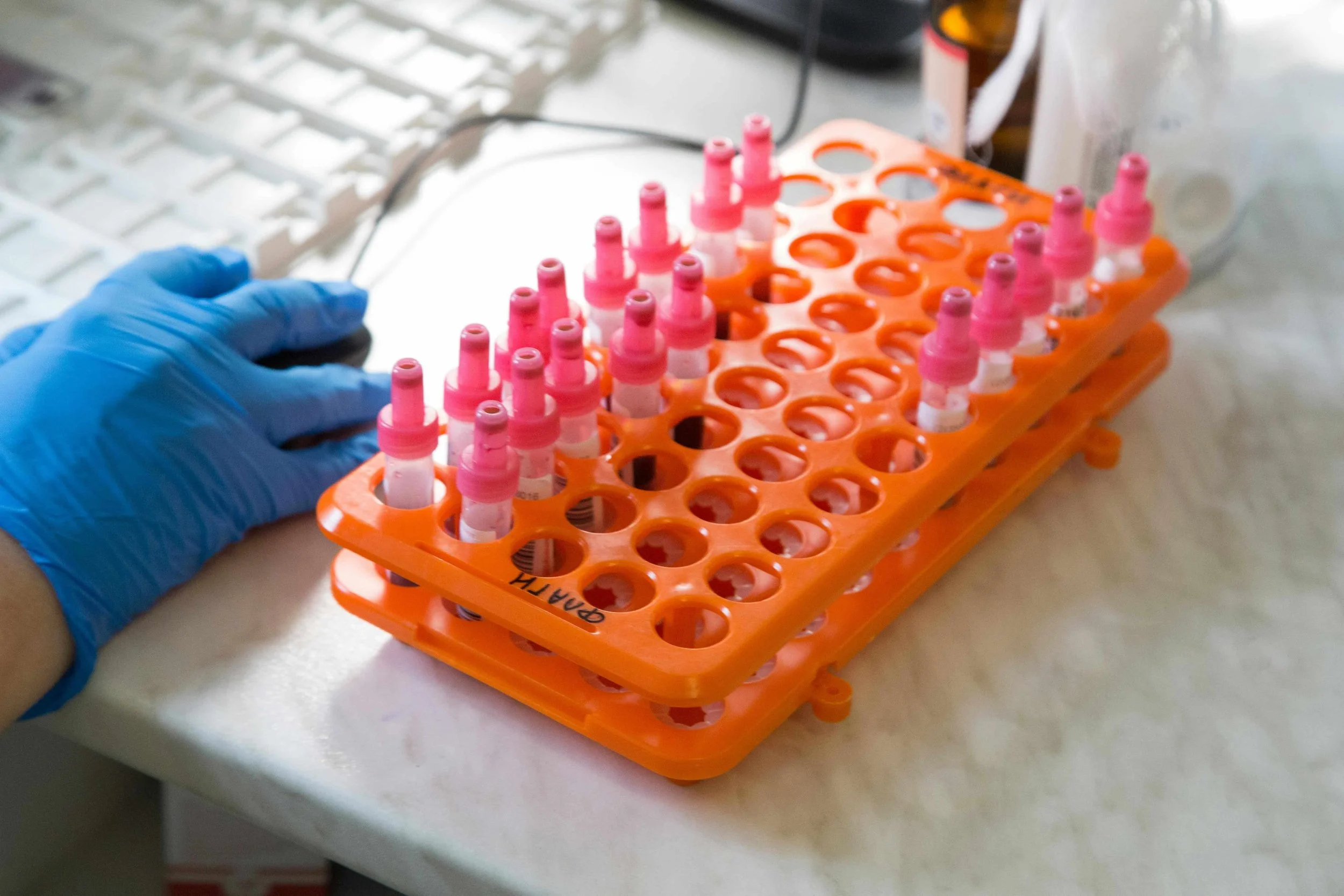 A gloved laboratory technician's hand resting beside an orange rack filled with pink-capped blood sample vials.