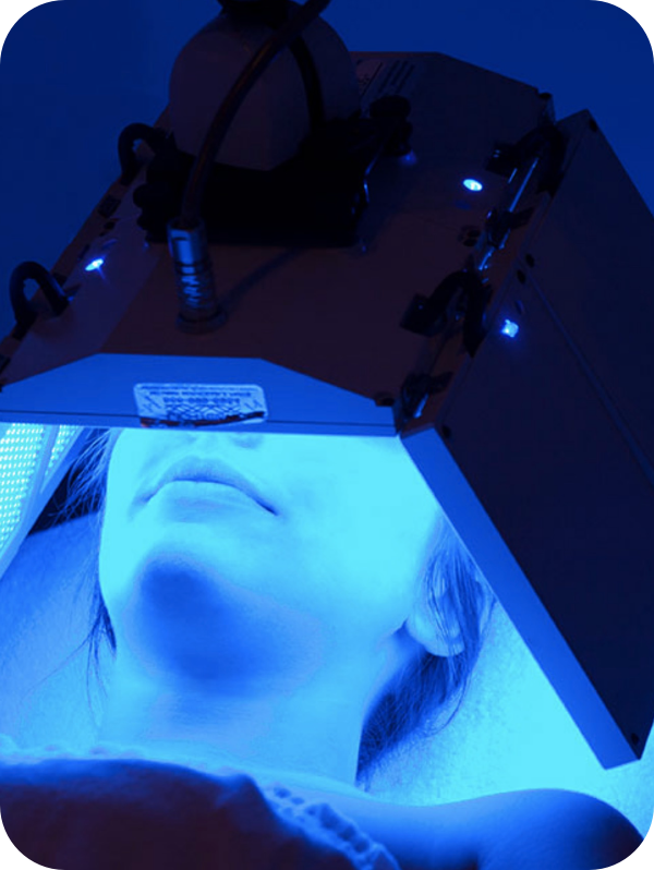 Blue Light Therapy Umbrella