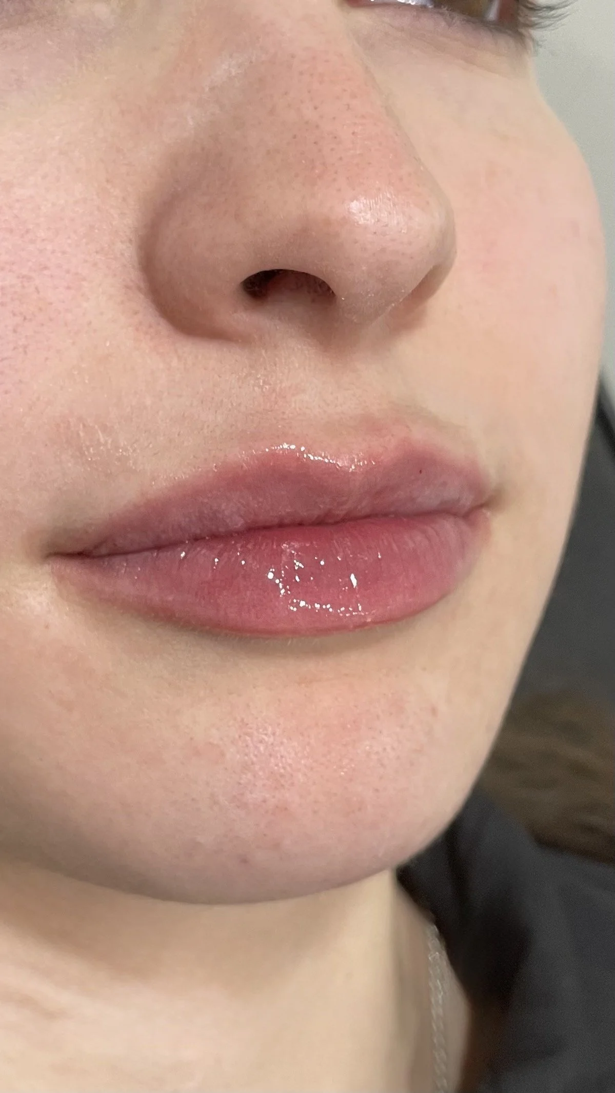 Close-up of a person's nose and lips with lip gloss, smooth skin, and subtle freckles.