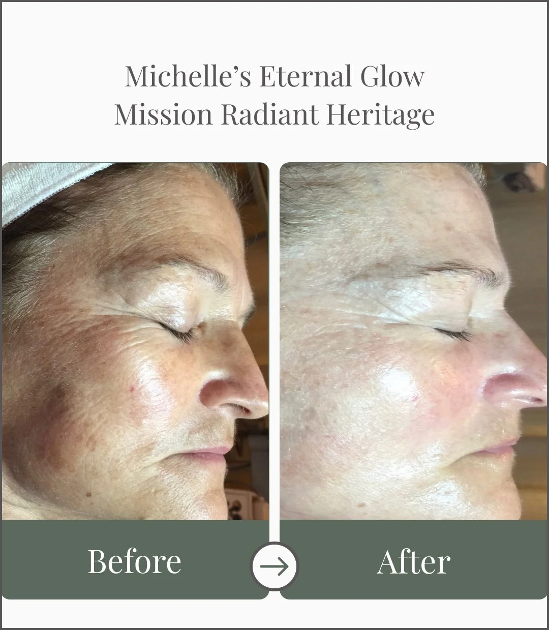 Side-by-side comparison of a woman's face before and after skincare treatment, showing improved skin texture and glow.
