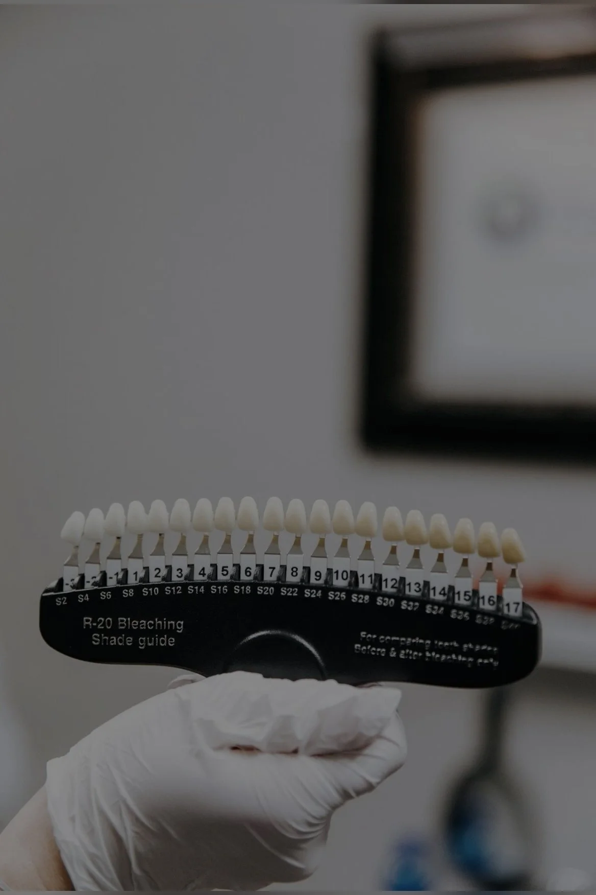 TEETH WHITENING CONSULTATION