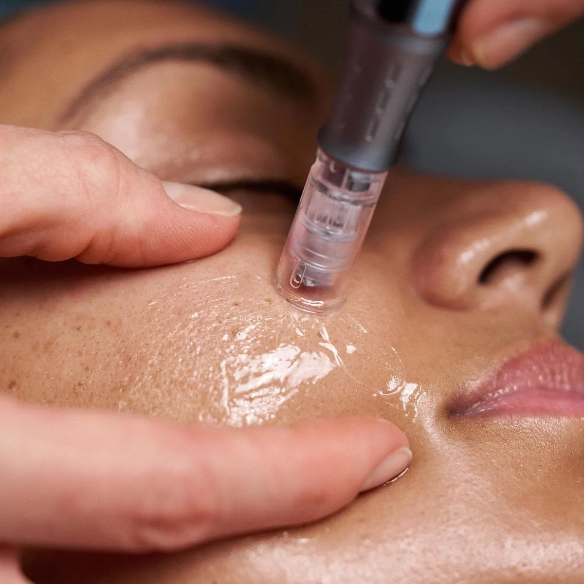 NANOINFUSION FACIAL