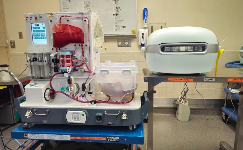 Operationalizing Normothermic Machine Perfusion for High-Risk Liver Recovery