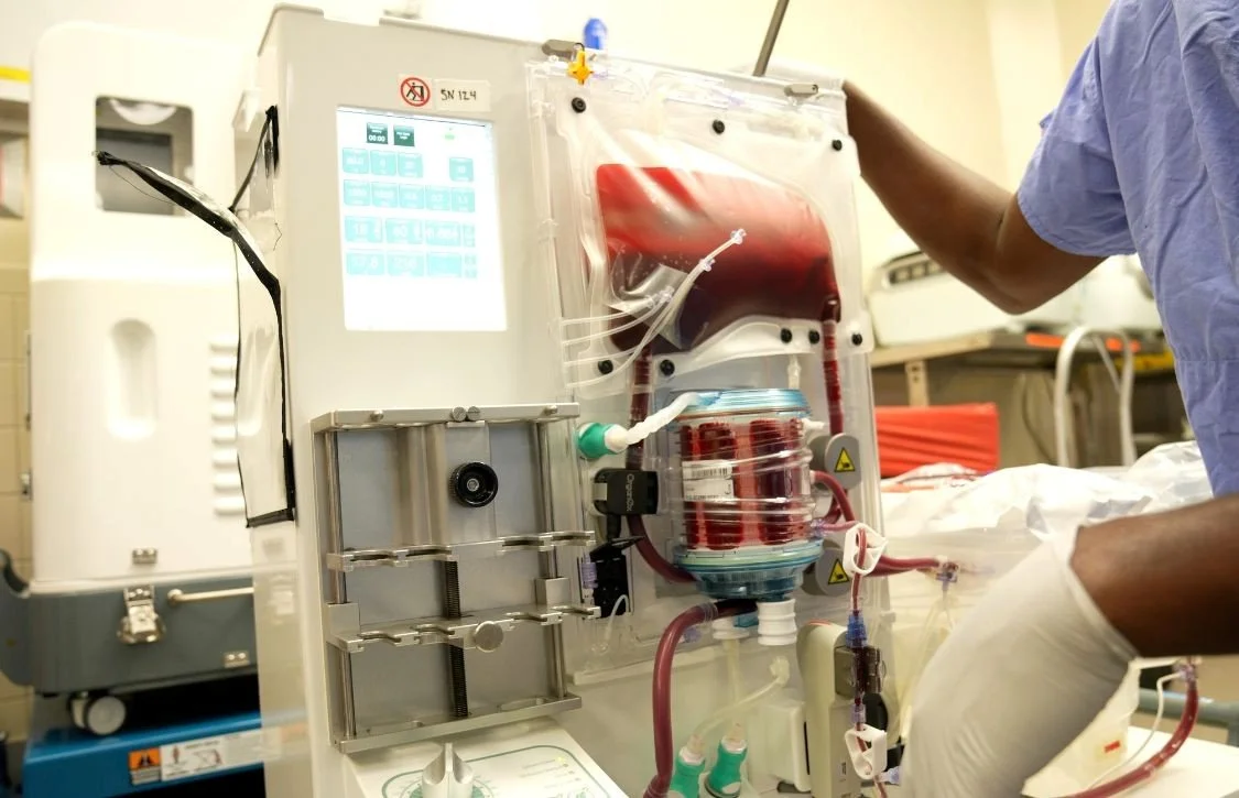 Technical Innovation in Organ Transplantation: A Roadmap for Administrators