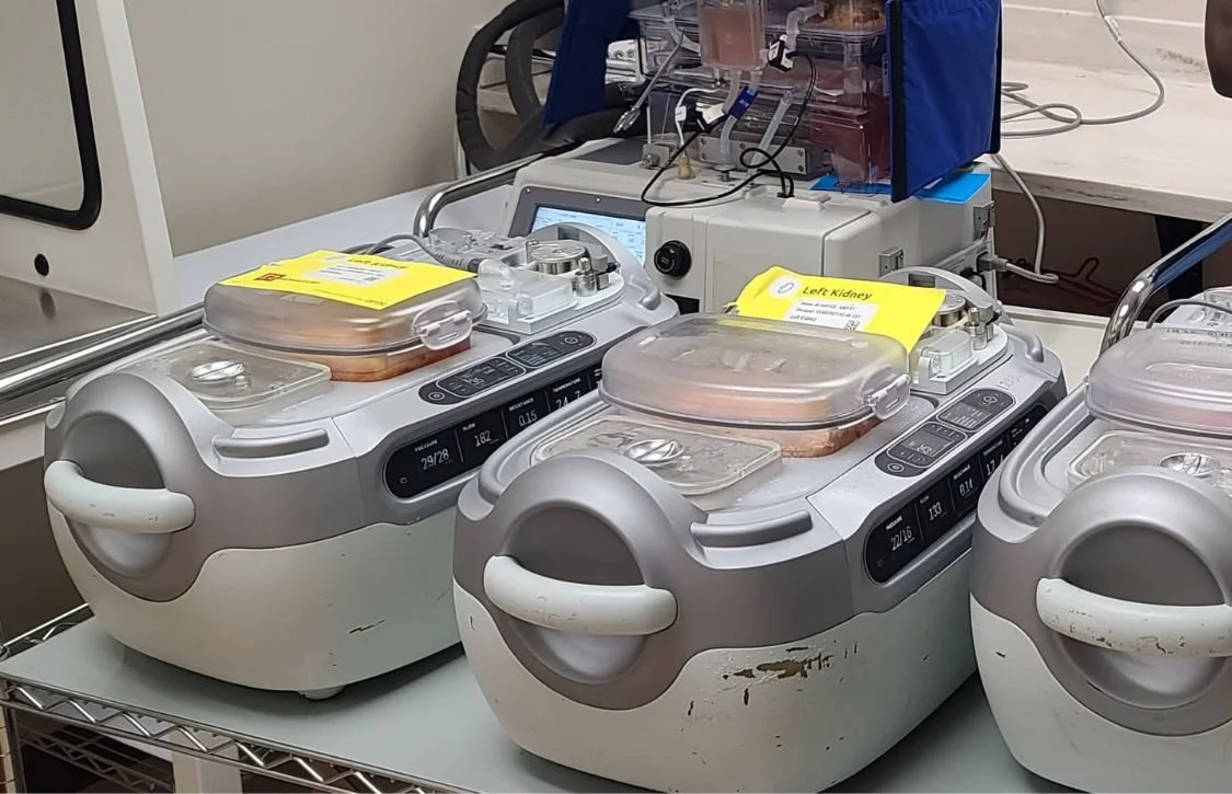 Evaluating the Success Metrics of Hospital-Based Perfusion Programs